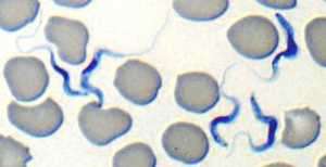 parasites trypanosomiasis