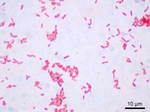 Flashcards - Results of gram stain