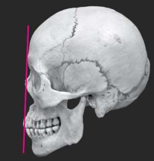 Flashcards - Parts of Skull