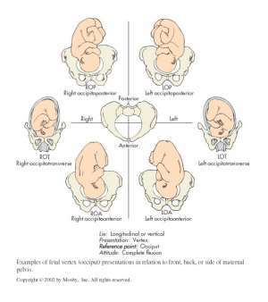 Flashcards - Nurs509A Exam 2