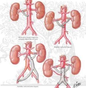 Flashcards - Two8 86 Renal Physiology and Pathophysiology including ...