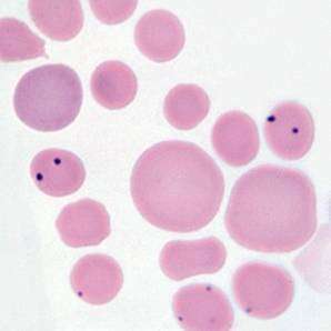 Flashcards - Blood Parasites