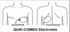 cardioversion cardiac synchronized defibrillators defibrillation flashcards aicd defibrillator