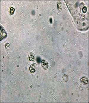 Flashcards - CL-LAB-Pictures!Urinalysis