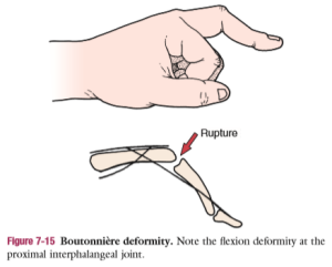 Flashcards - Upper Extremity