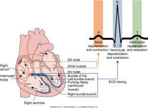 Flashcards - Patho Heart