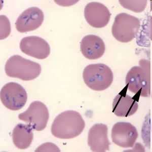 parasites identify parasite smear