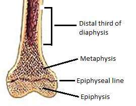 Flashcards - PAP-591 Orthopedics