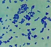 Flashcards - Ear Cytology