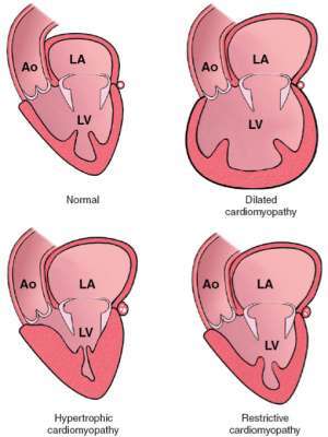 Flashcards - Path Heart III (13)