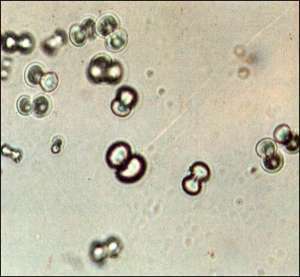 Flashcards - CL-LAB-Pictures!Urinalysis