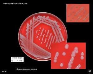 white%20staphylococcus%20aureus