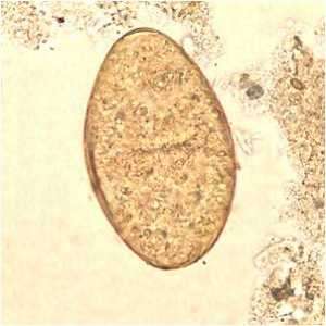 Flashcards - Parasitology - Trematodes